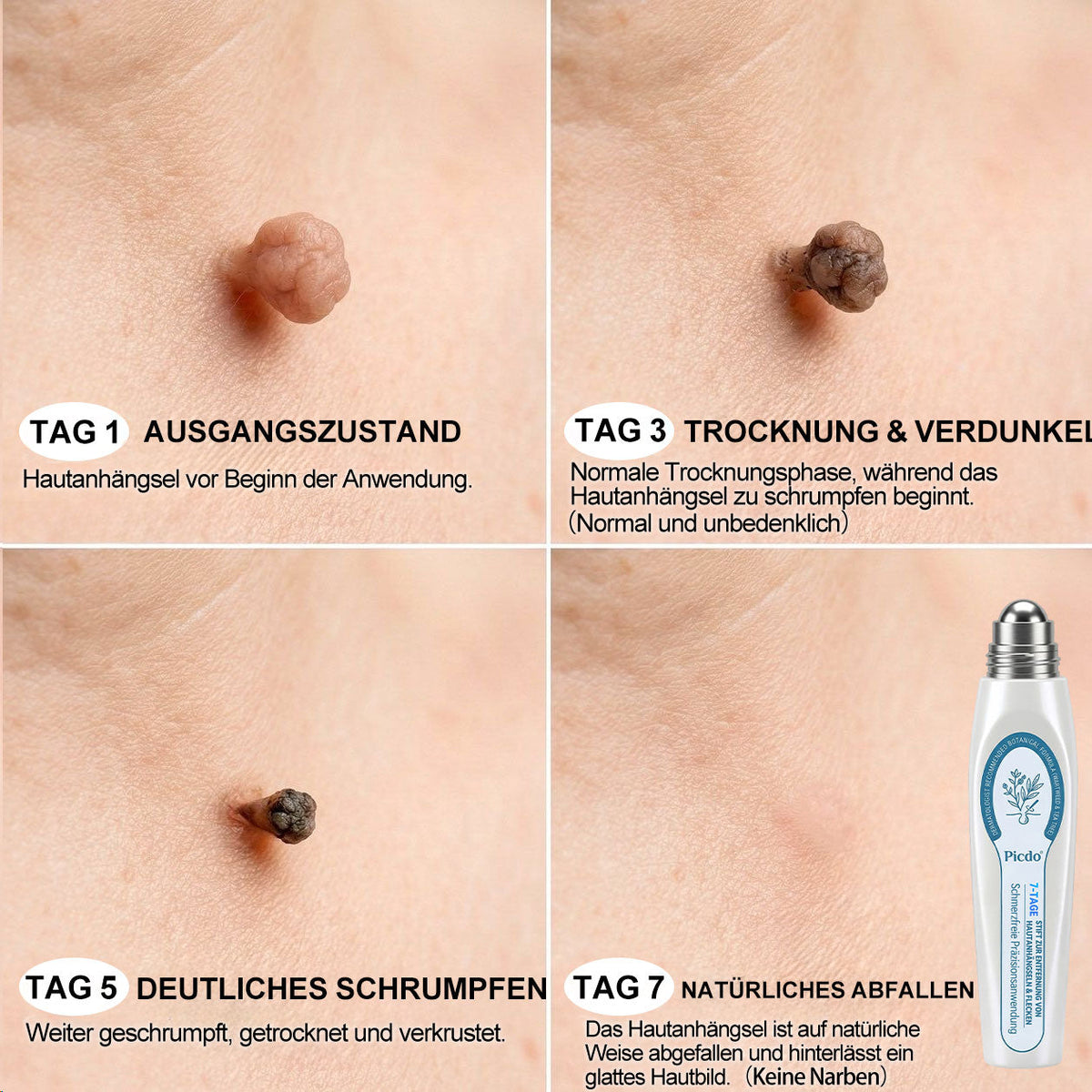🎉𝐏i𝐜𝐝o®Glückwunsch! Du bist unser großer Gewinner 🎁! 🛍️ Als unser Glücksstern erhältst du 50 % Rabatt – das ist die Hälfte des Preises deiner Bestellung! Nutze jetzt deine Chance und sichere dir dieses Angebot, bevor es endet! ✨