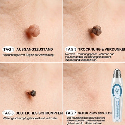 🎉𝐏i𝐜𝐝o®Glückwunsch! Du bist unser großer Gewinner 🎁! 🛍️ Als unser Glücksstern erhältst du 50 % Rabatt – das ist die Hälfte des Preises deiner Bestellung! Nutze jetzt deine Chance und sichere dir dieses Angebot, bevor es endet! ✨