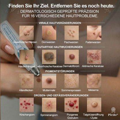 🎉𝐏i𝐜𝐝o®Glückwunsch! Du bist unser großer Gewinner 🎁! 🛍️ Als unser Glücksstern erhältst du 50 % Rabatt – das ist die Hälfte des Preises deiner Bestellung! Nutze jetzt deine Chance und sichere dir dieses Angebot, bevor es endet! ✨
